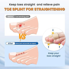 Hyggear™ Hammer Toe Straightener - 1193645271304