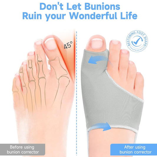 HYGGEAR Großzehen-Bunion-Korrektor (Hallux Valgus).