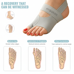HYGGEAR Großzehen-Bunion-Korrektor (Hallux Valgus).